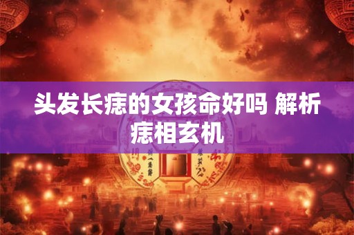 详细阅读:头发长痣的女孩命好吗 解析痣相玄机 头发长痣的女孩命好吗 解析痣相玄机