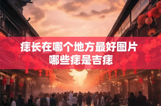 痣长在哪个地方最好图片 哪些痣是吉痣